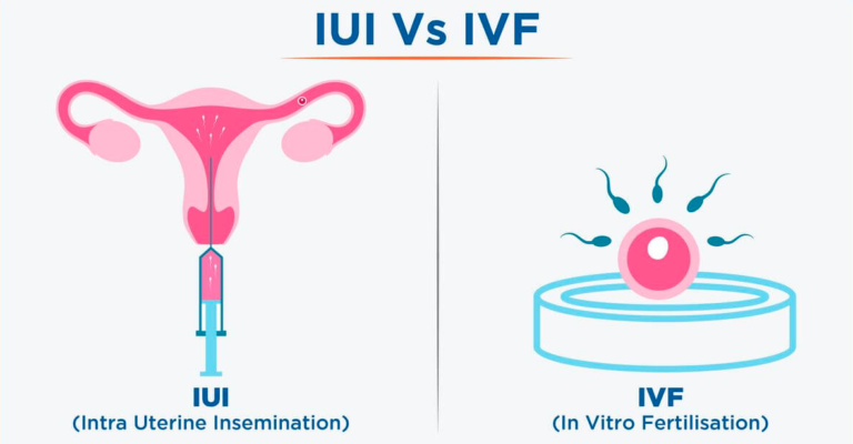 Iui Vs Ivf Cost Factor Success Rate What Is Right For You Ihr India 