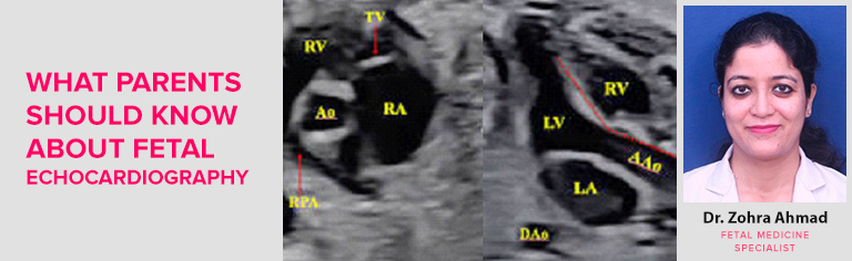 FETAL ECHOCARDIOGRAPHY: THE PURPOSE, PROCEDURE & RISKS