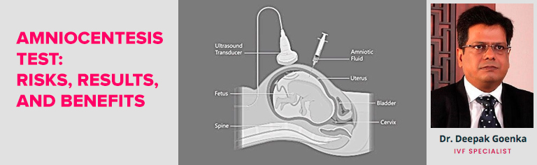 Understanding Amniocentesis Test: Risks, Results, and Benefits