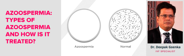 What is Azoospermia and How is it Treated?