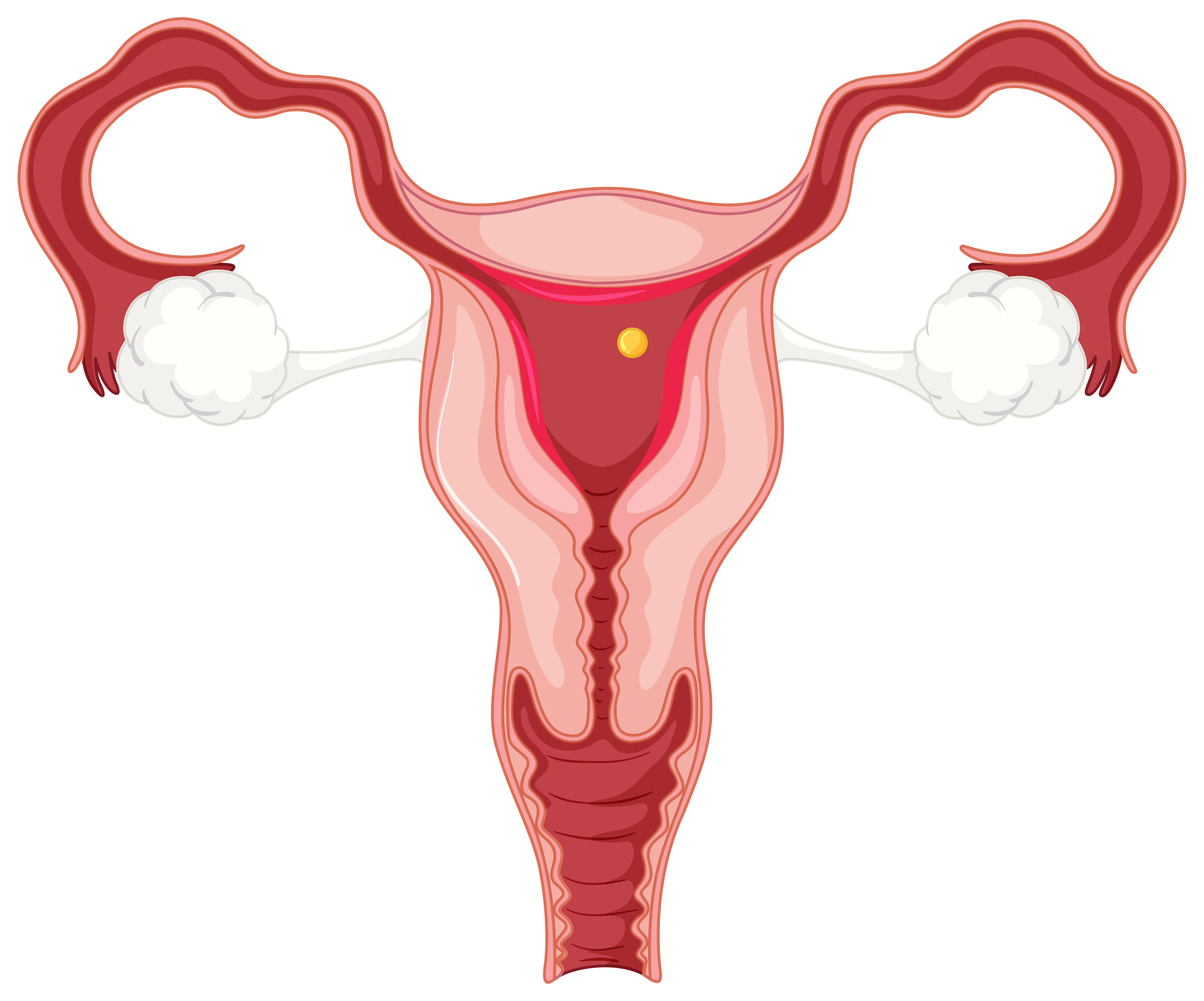 Can You Still Get Pregnant If Your Fallopian Tubes Are Blocked?